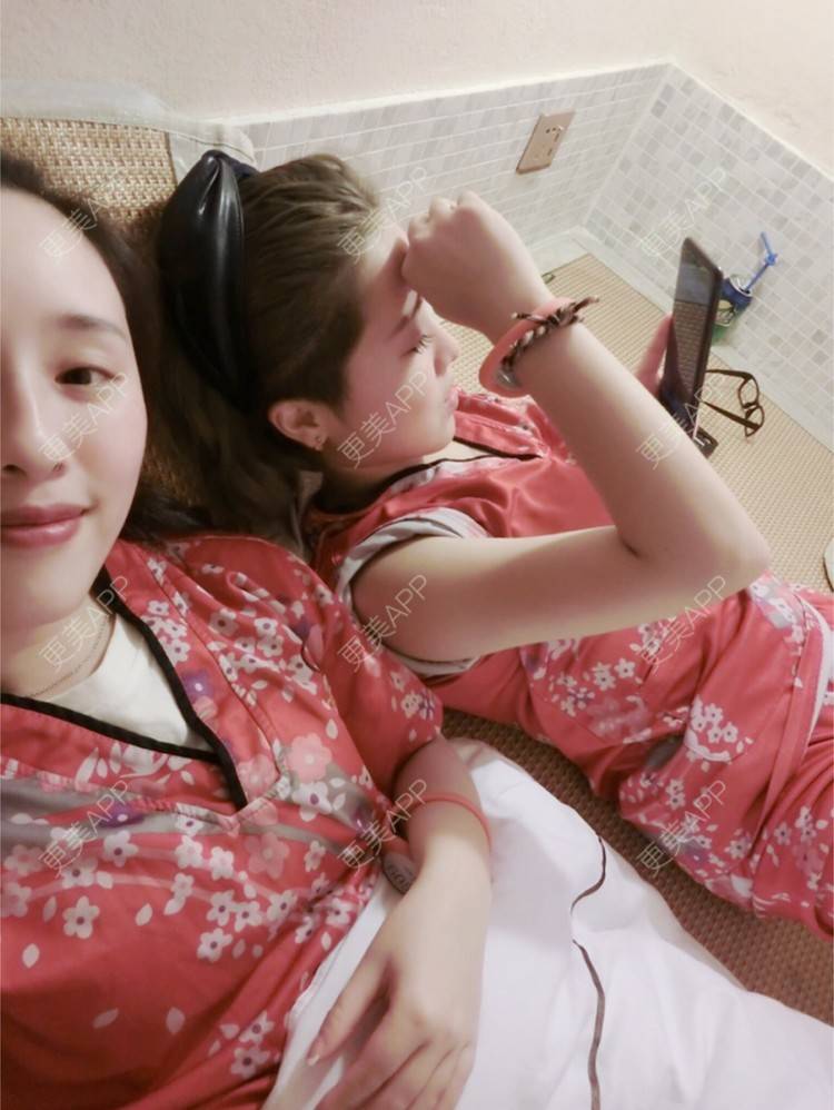 更美 - Joni小小板娘的射频溶脂瘦手臂经验 | 上海 | 射频溶脂瘦手臂 | 视频日记