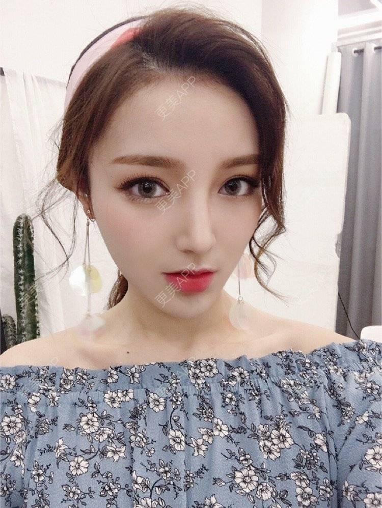 小郡的双眼皮日记