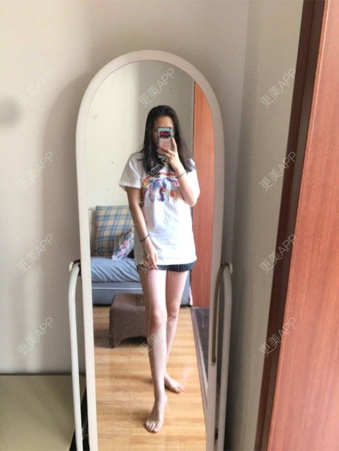 更美 - 晚清木子的吸脂经验 | 抽脂瘦腿 | 瘦身美体 | 吸脂 | 武汉