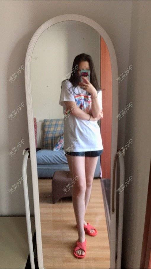 更美 - 晚清木子的吸脂经验 | 抽脂瘦腿 | 瘦身美体 | 吸脂 | 武汉