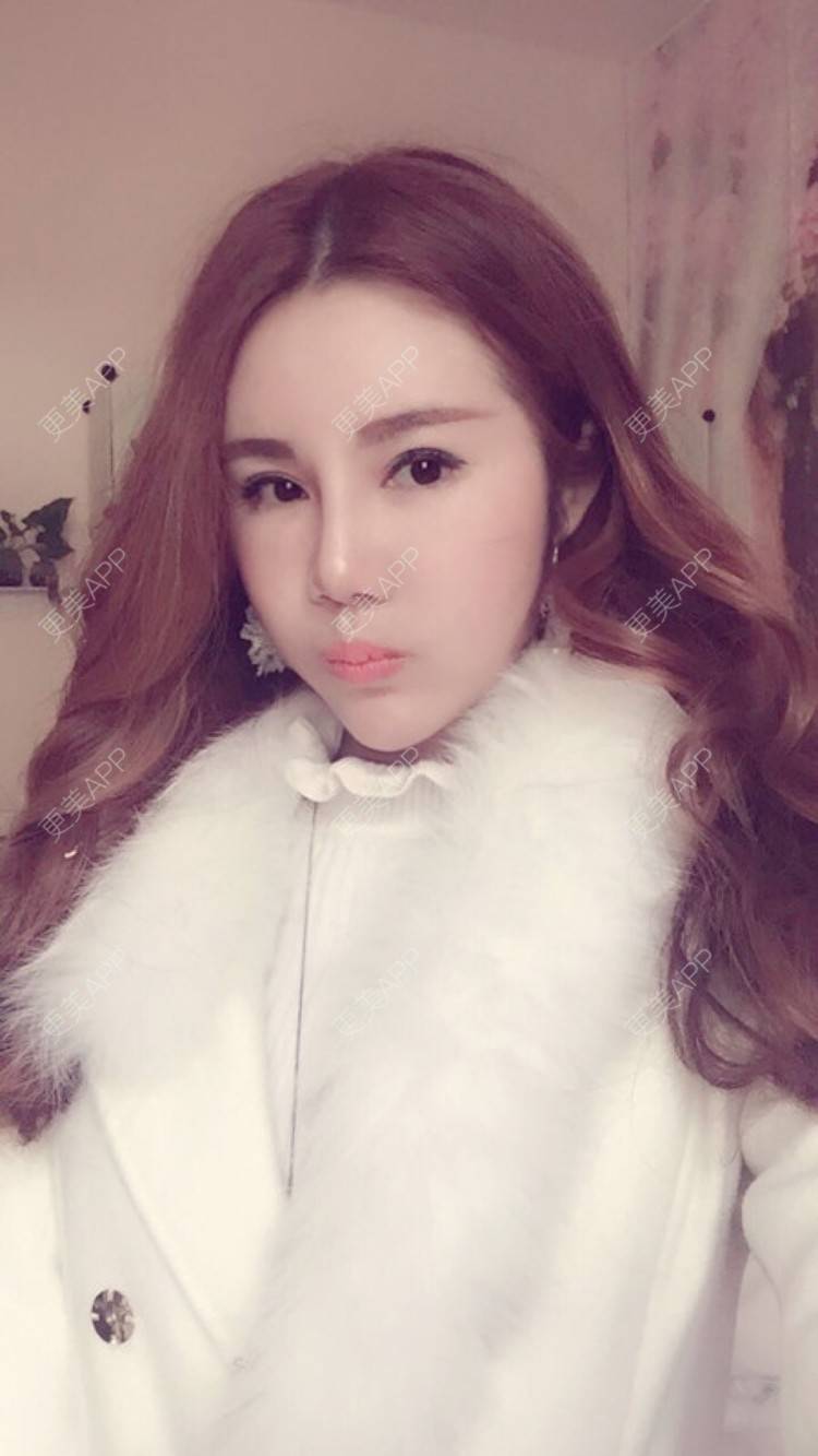 让我心痛你做的佷箌莅的全脸整形套餐日记