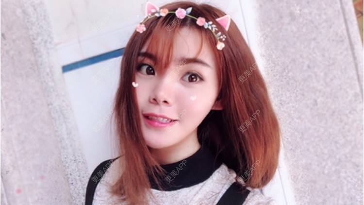 更美 - 更美用户AgQYDXgJwA的半永久纹眉经验 | 全切双眼皮 | 武汉 | 长沙 | 杭州 | 半永久纹眉 | 深圳 | 注射塑形腿部 | 颈部 | 玻尿酸