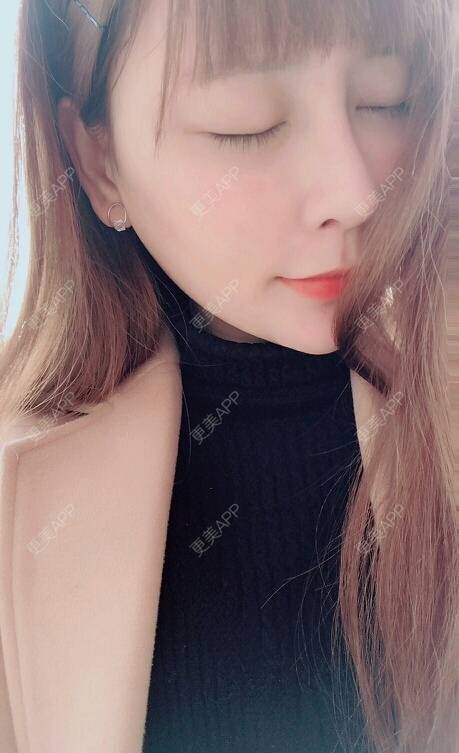 更美 - 更美用户UghAA5DIDC的微针水光经验 | 水光项目 | 微针水光