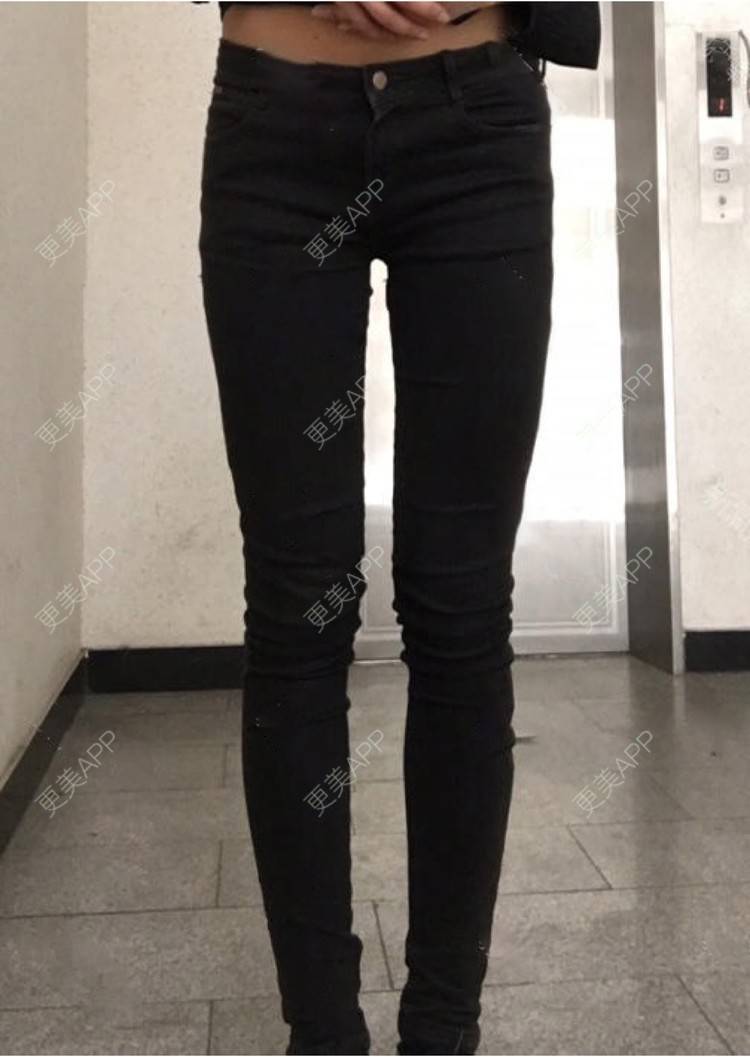 更美 - 蔡东亮 医生的吸脂瘦大腿经验 | 吸脂瘦大腿