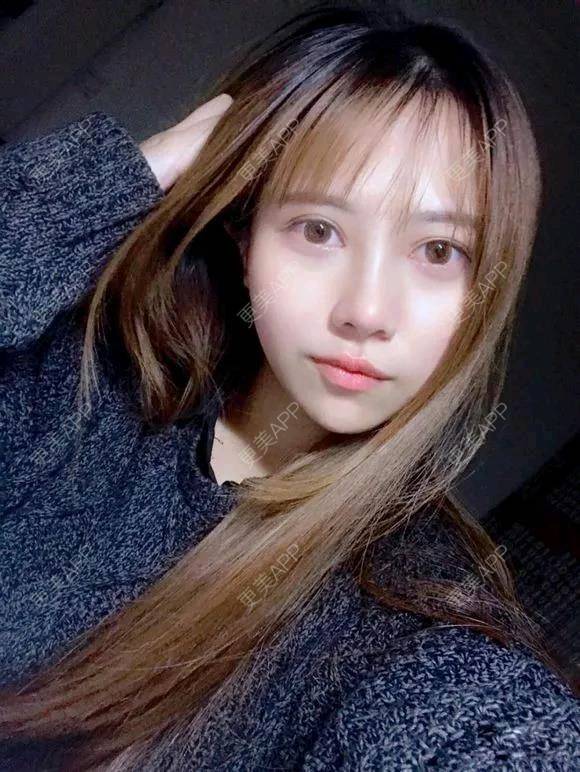 更美 - 更美用户a9htlwcVmM的水光项目经验 | 处女膜修复 | 水光项目 | 埋线提升 | 双眼皮 | 瘦脸除皱 | 祛眼袋 | 定点双眼皮 | 埋线隆鼻 | 广州