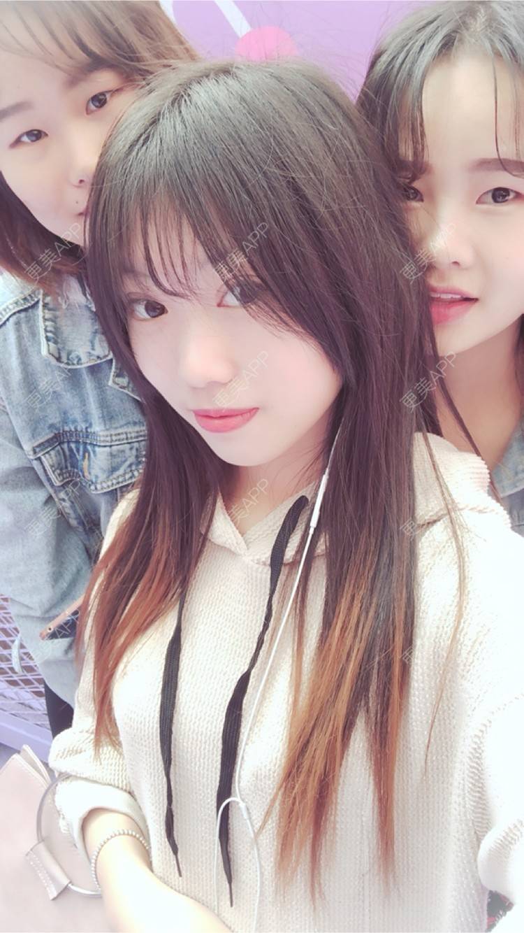 更美 - 更美用户oj4IIT2zhJ的定点双眼皮经验 | 厦门 | 定点双眼皮