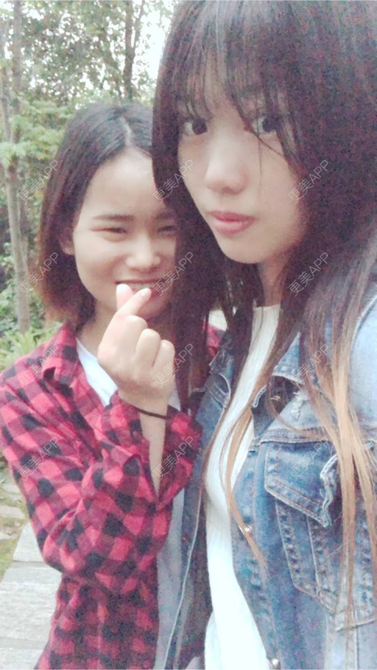 更美 - 更美用户oj4IIT2zhJ的定点双眼皮经验 | 厦门 | 定点双眼皮