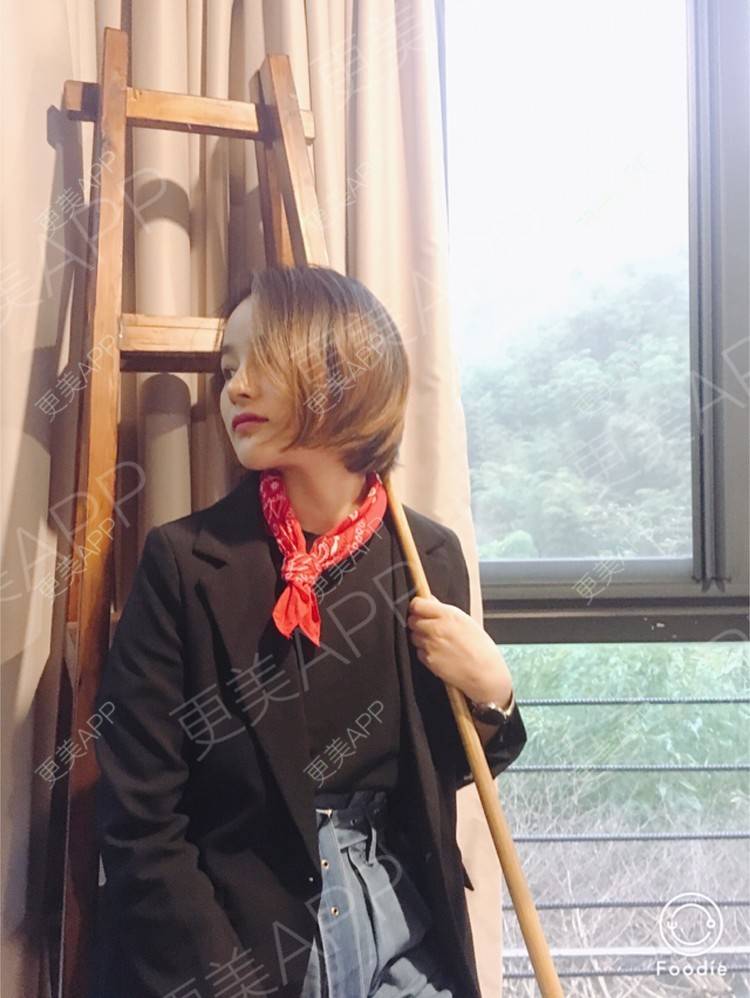 更美 - 更美用户7JqOSIso4n的鼻部多项经验 | 假体取出 | 肋软骨垫鼻尖 | 鼻部多项 | 杭州