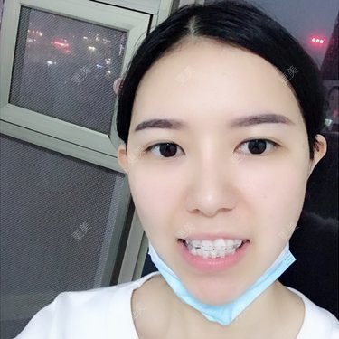 小凤