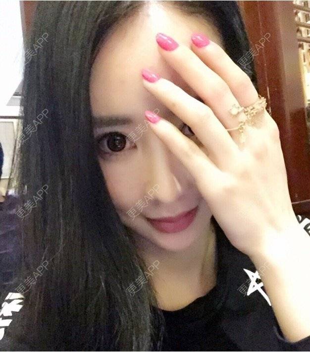 更美 - 凡先生的小媳妇的经验 | 小阴唇肥大 | 重庆