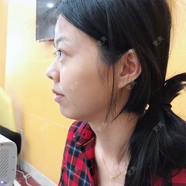 🍭会飞的鱼儿