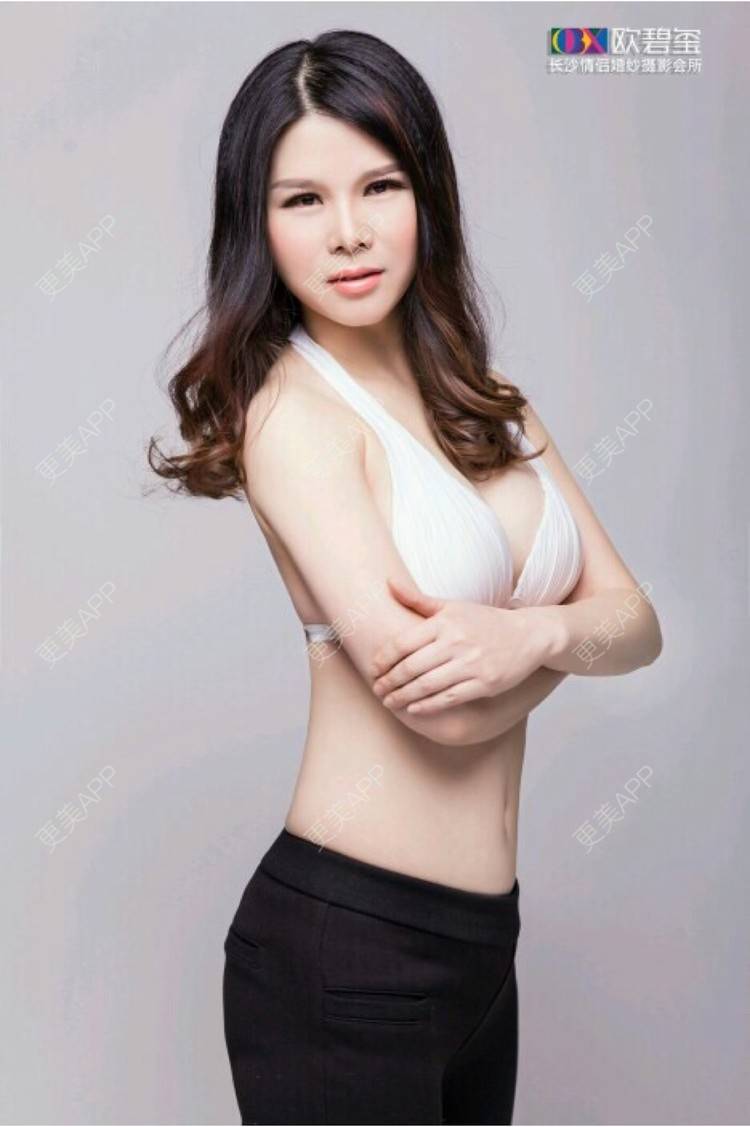 更美 - 未来的芭芭拉的除皱瘦脸经验 | 眼部修复 | 隆胸 | 北京 | 双眼皮 | 上海 | 鼻部综合 | 毛发移植 | 广州 | 南昌 | 昆明 | 埋线隆鼻 | 南宁 | 眼部多项 | 郑州 | 杭州 | 肋软骨隆鼻 | 祛眼袋 | 自体脂肪隆胸 | 除皱瘦脸 | 埋线提升 | PRP自体血清美肤 | 长沙