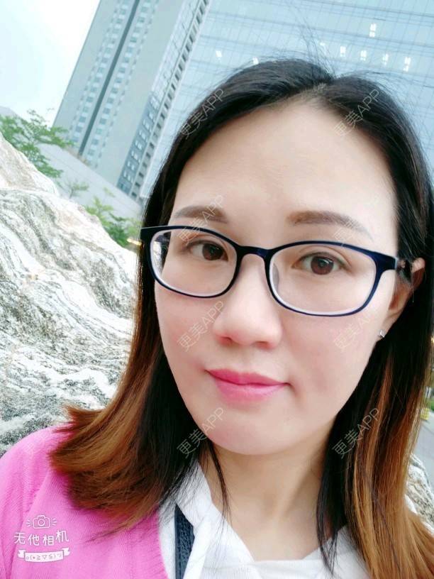 更美 - Suki Liang的自体脂肪全面部填充经验 | 自体脂肪全面部填充 | 视频日记 | 长沙