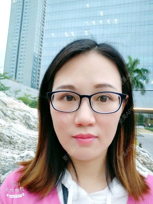 更美 - Suki Liang的自体脂肪全面部填充经验 | 自体脂肪全面部填充 | 视频日记 | 长沙