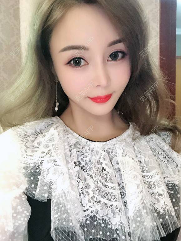更美 - 丹霞似锦的经验 | 广州 | 鼻部膨体假体取出