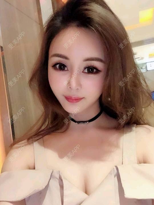 更美 - 丹霞似锦的经验 | 广州 | 鼻部膨体假体取出