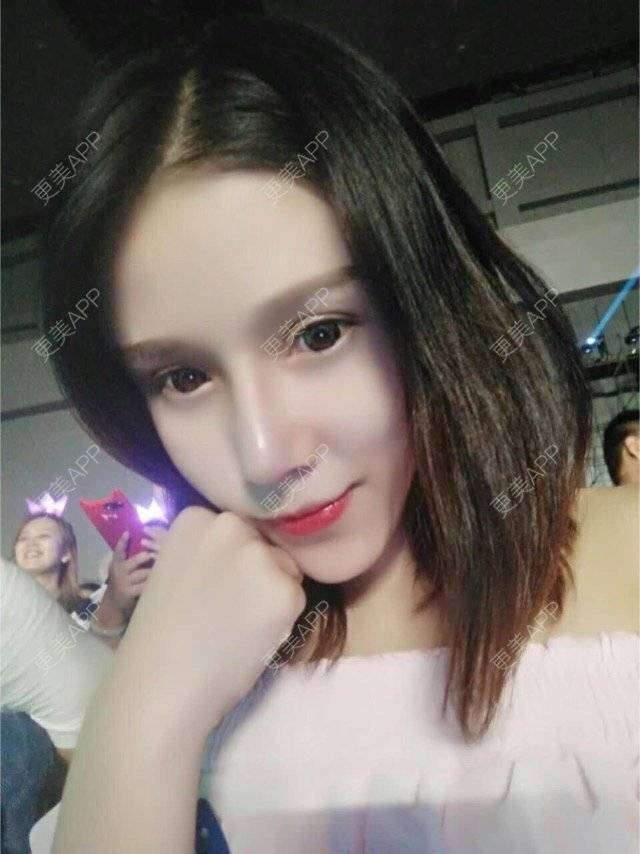 小鑫鑫吖的隆鼻日记