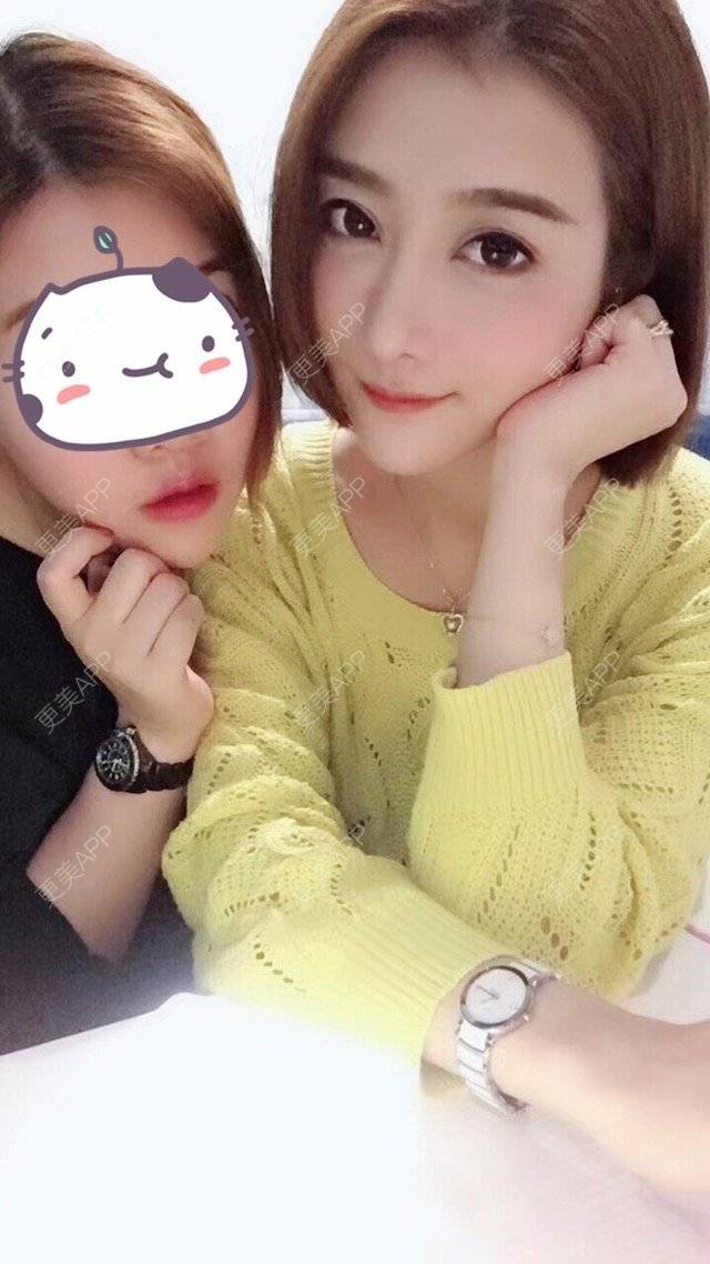 更美 - 莹莹D緈諨的鼻部多项经验 | 视频日记 | 自体软骨隆鼻 | 鼻部多项 | 膨体隆鼻 | 广州 | 驼峰鼻矫正 | 鼻形态修复