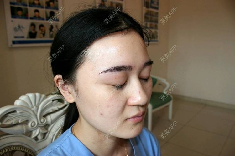 更美 - 暖心茜茜的植眉经验 | 上海 | 植眉