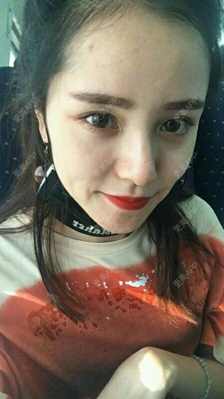 更美 - 请叫我灰姑娘GAO的果酸焕肤经验 | 果酸焕肤 | 南宁