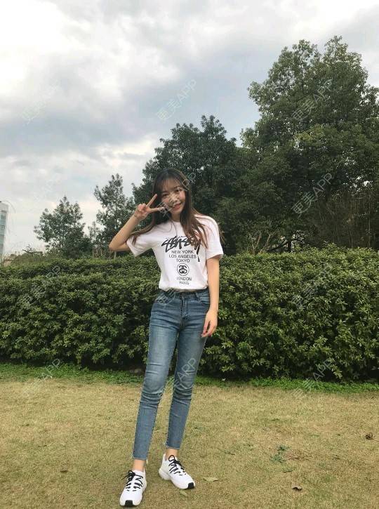 更美 - 三生三世苗媛泻的吸脂瘦大腿经验 | 吸脂瘦大腿 | 长沙