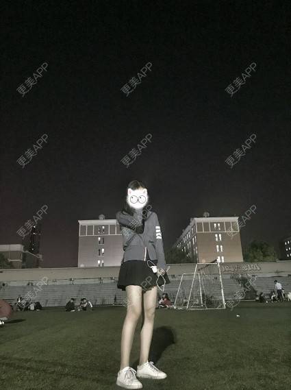 更美 - 三生三世苗媛泻的吸脂瘦大腿经验 | 吸脂瘦大腿 | 长沙