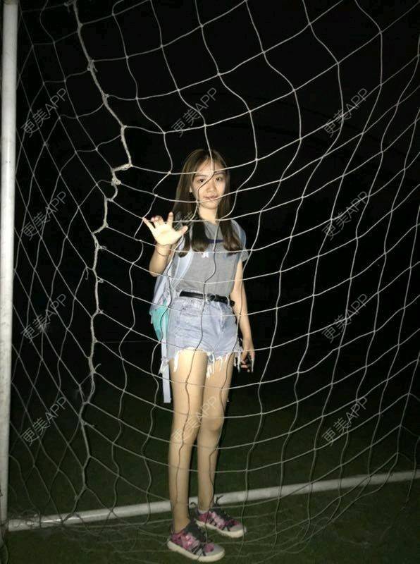 更美 - 三生三世苗媛泻的吸脂瘦大腿经验 | 吸脂瘦大腿 | 长沙