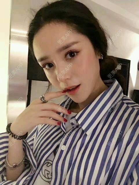 更美 - 请叫我灰姑娘GAO的果酸焕肤经验 | 果酸焕肤 | 南宁