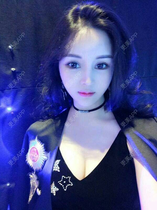 更美 - 更美用户SpK2K9g9QA的玻尿酸卧蚕经验 | 成都 | 玻尿酸卧蚕