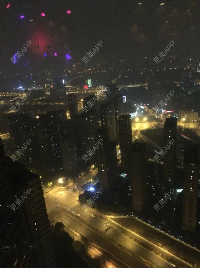 更美 - 钟无意的面部脱毛经验 | 面部脱毛 | 南京