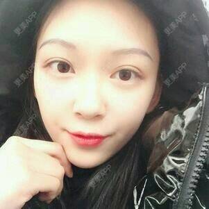 更美 - 黄鹂鸣翠柳的鼻部膨体假体取出经验 | 鼻部膨体假体取出 | 温州