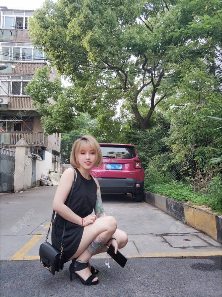 更美 - Joni小小板娘的射频溶脂瘦手臂经验 | 上海 | 射频溶脂瘦手臂 | 视频日记