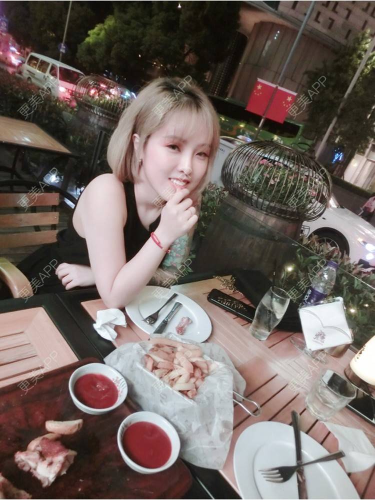 更美 - Joni小小板娘的射频溶脂瘦手臂经验 | 上海 | 射频溶脂瘦手臂 | 视频日记