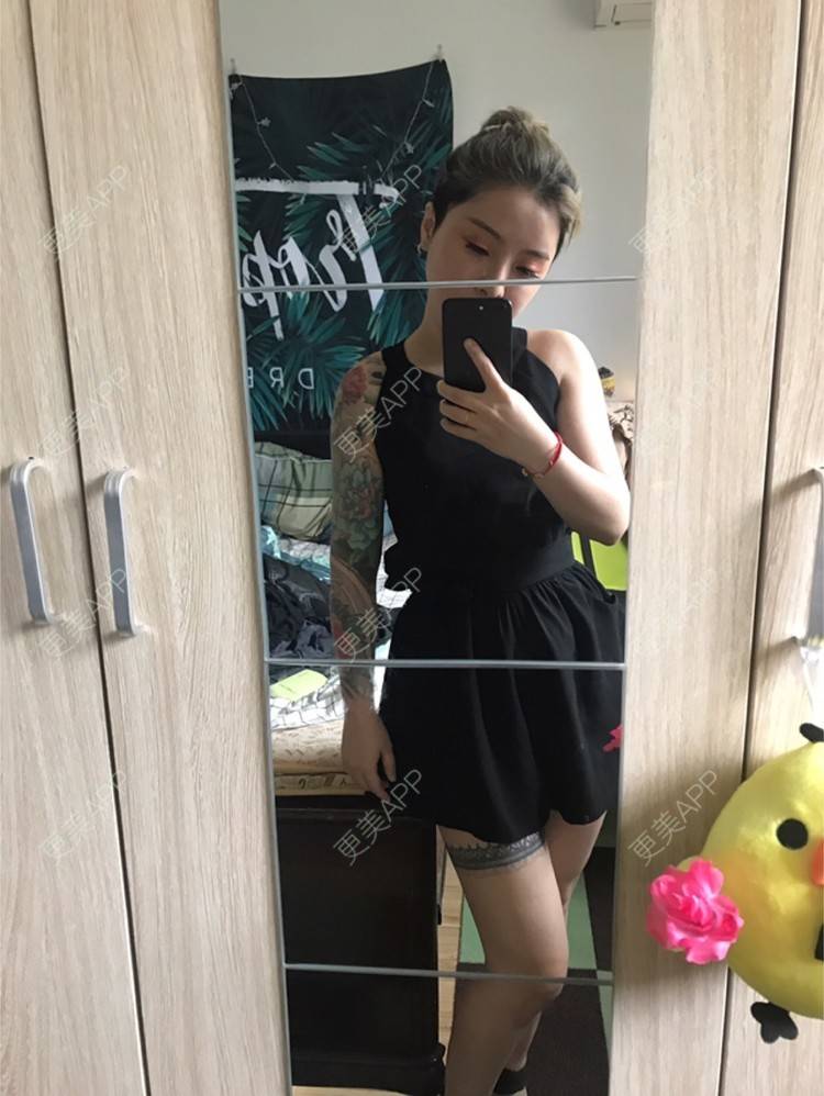 更美 - Joni小小板娘的射频溶脂瘦手臂经验 | 上海 | 射频溶脂瘦手臂 | 视频日记