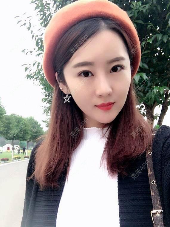 更美 - 更美用户VIAxLKVbJ9的彩光嫩肤经验 | 彩光嫩肤 | 广州