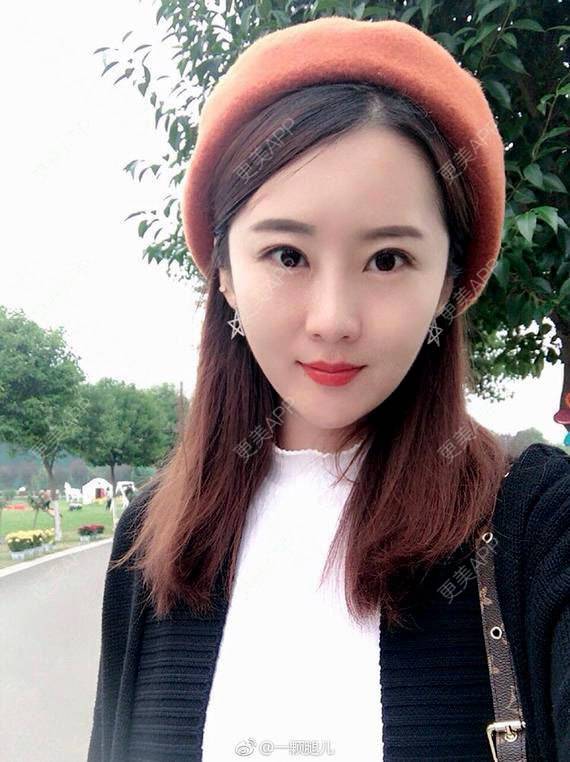 更美 - 更美用户VIAxLKVbJ9的彩光嫩肤经验 | 彩光嫩肤 | 广州