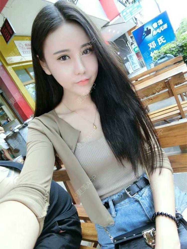 更美 - 我爱吃芝麻的经验 | 吸脂 | 武汉 | 自体脂肪垫下巴