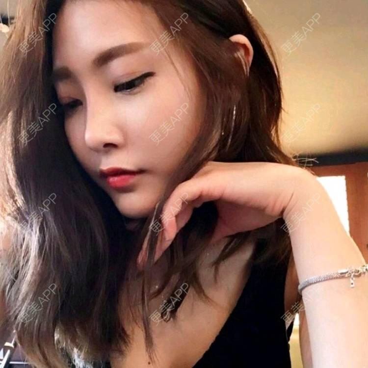 更美 - 逗丁伲R的鼻部综合经验 | 鼻部综合 | 果酸焕肤 | 自体脂肪面部年轻化 | 除皱瘦脸 | 镭射净肤 | 双眼皮 | 注射美白 | 玻尿酸 | 吸脂 | 上海