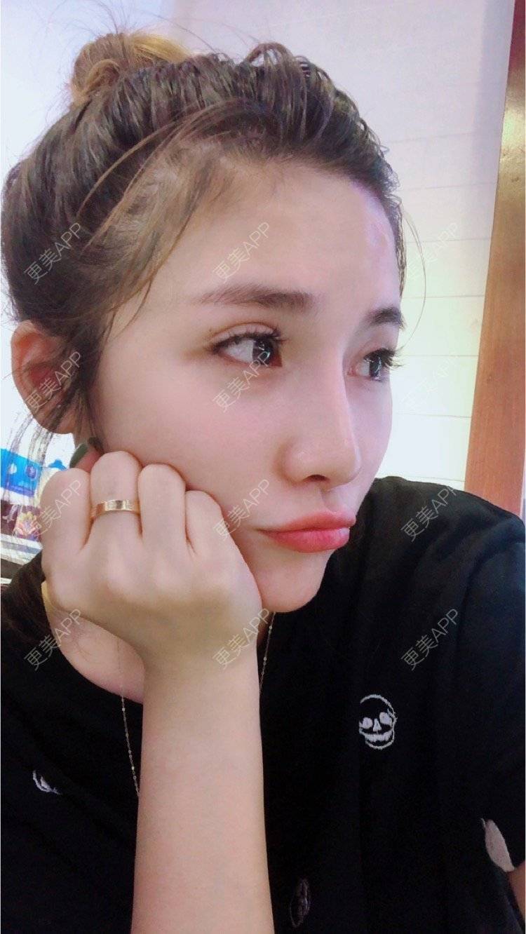 迷雾中的风的鼻综合日记