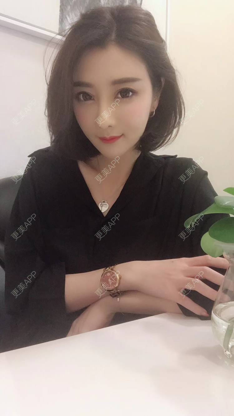 更美 - 莹莹D緈諨的鼻部多项经验 | 视频日记 | 隆鼻 | 鼻部多项 | 膨体隆鼻 | 广州 | 驼峰鼻矫正 | 鼻形态修复