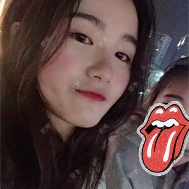 小山初代的除皱瘦脸日记