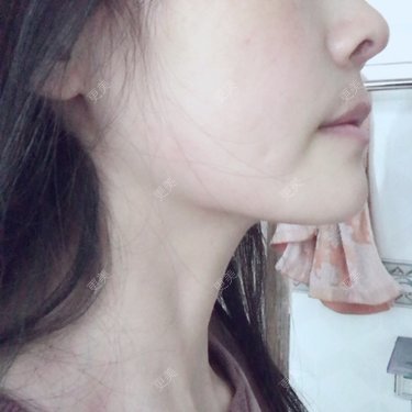 喵星球上的女王