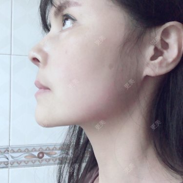 喵星球上的女王