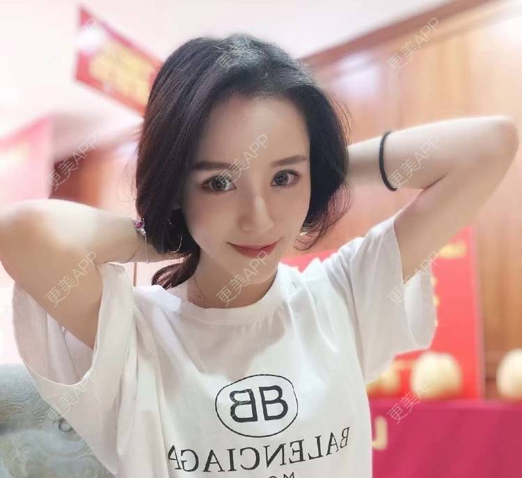 更美 - 请叫我灰姑娘GAO的果酸焕肤经验 | 南宁 | 果酸焕肤