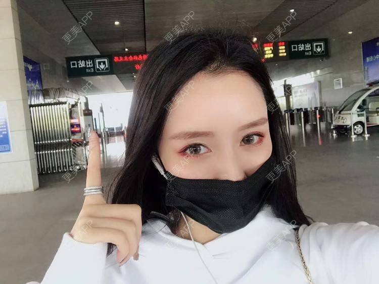 更美 - 请叫我灰姑娘GAO的果酸焕肤经验 | 南宁 | 果酸焕肤