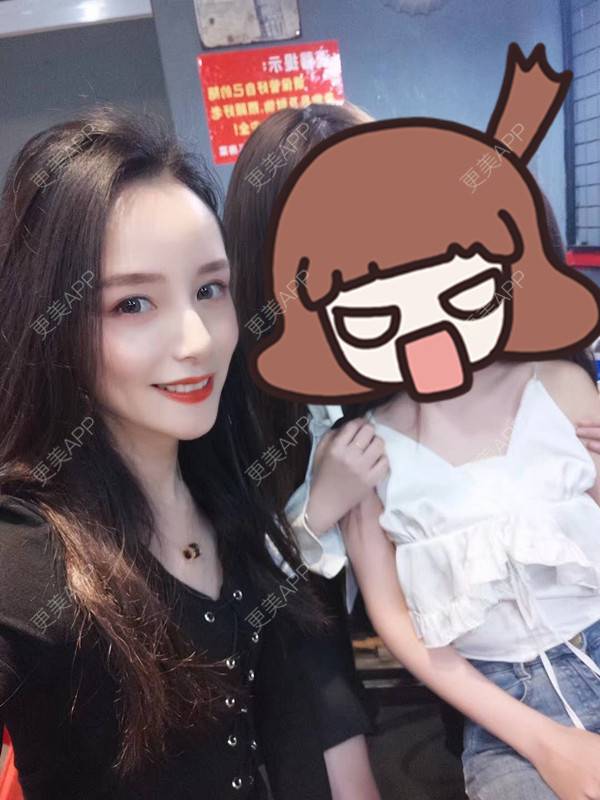 更美 - 请叫我灰姑娘GAO的果酸焕肤经验 | 南宁 | 果酸焕肤