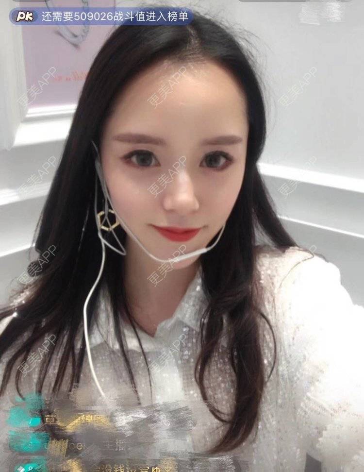 更美 - 请叫我灰姑娘GAO的果酸焕肤经验 | 南宁 | 果酸焕肤