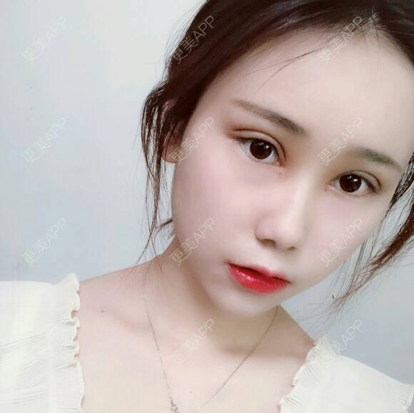 你想的有点多吧的双眼皮日记