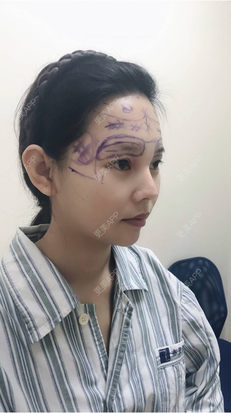 芭比萝莉的膨体垫眉弓日记