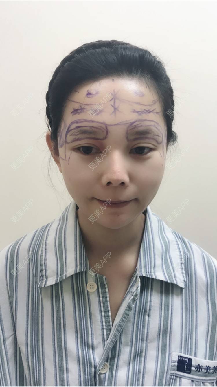 芭比萝莉的膨体垫眉弓日记